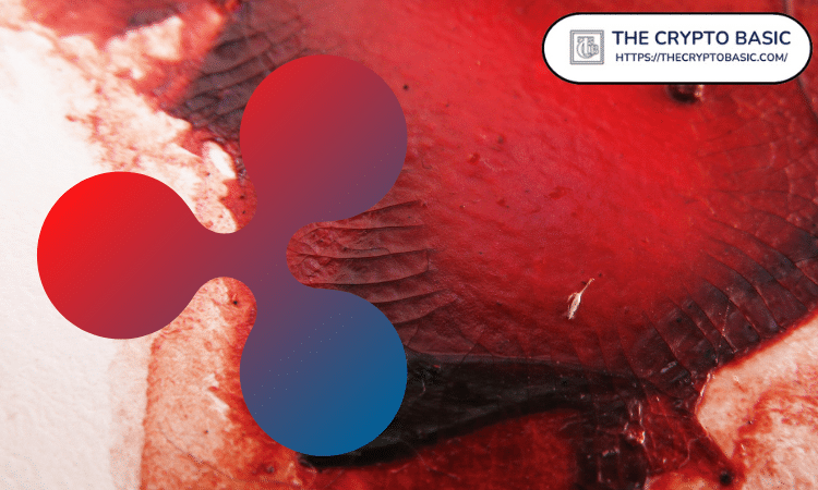Bloodbath if ripple loses from SEC