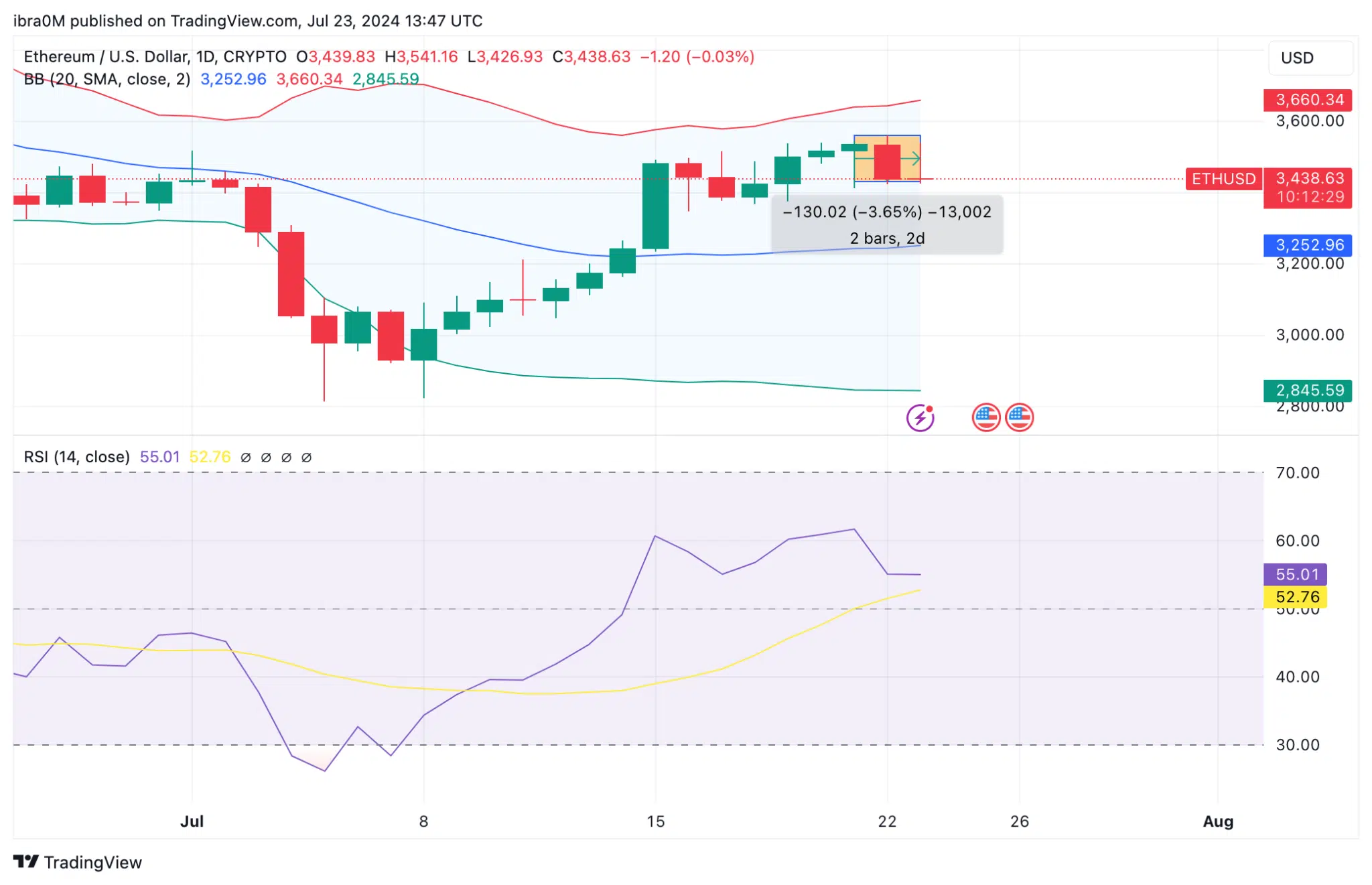 Ethereum Price Forecast | ETH/USD