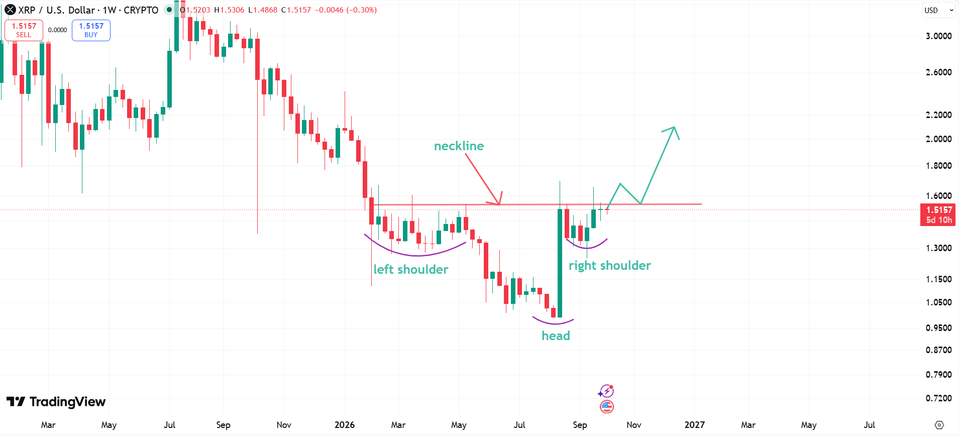 XRP Inverse Head and Shoulders Pattern XRP Inverse Head and Shoulders Pattern